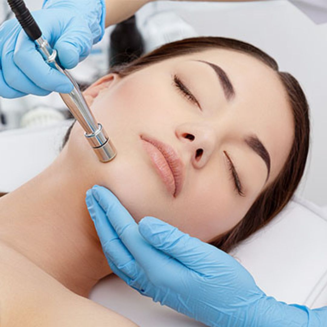 Microdermabrasion Varcas Wellness Bangalore